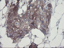 Monoclonal Mouse anti-Human GORAB / SCYL1BP1 Antibody (clone OTI1E3, aa35-394, IHC, WB)