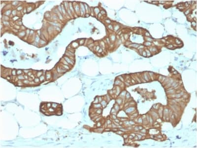 KRT19 / CK19 / Cytokeratin 19 Antibody (clone KRT19/1959R)