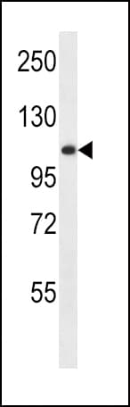 IHC-plus™ GAA / Alpha-Glucosidase, Acid Antibody (aa174-203)