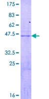Human RPL18 / Ribosomal Protein L18 (Recombinant GST)