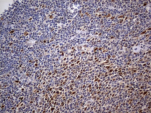 PPP2R1B Antibody (aa19-601, clone OTI8B6)