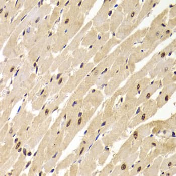 Polyclonal Rabbit anti-Human SNRPA / U1A Antibody (IHC, IF, WB)