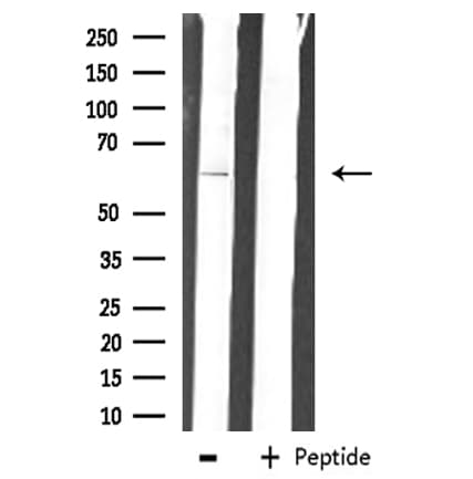 ZNF18 Antibody