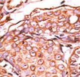 JUN / c-Jun Antibody (phospho-Ser63)