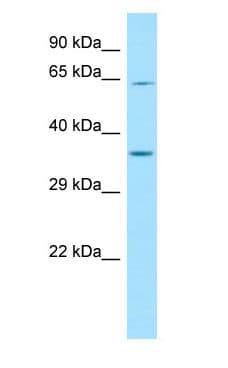 FIG1 / IL4I1 Antibody (aa486-535)