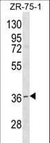 RNF144B Antibody (aa90-118)