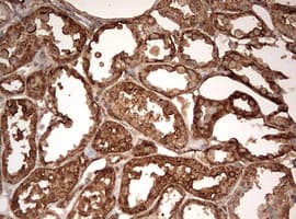 Monoclonal Mouse anti-Human GAPDH Antibody (clone OTI2F9, IHC, WB)