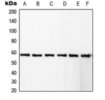 IHC-plus™ RCBTB1 Antibody (Internal)