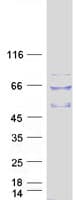 Human TULP2 Protein (Recombinant Myc-DDK (Flag))