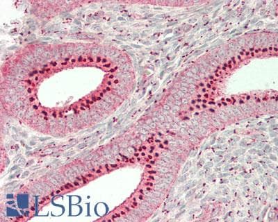 IHC-plus™ GOLM1 / GP73 / GOLPH2 Antibody (aa 36-401)