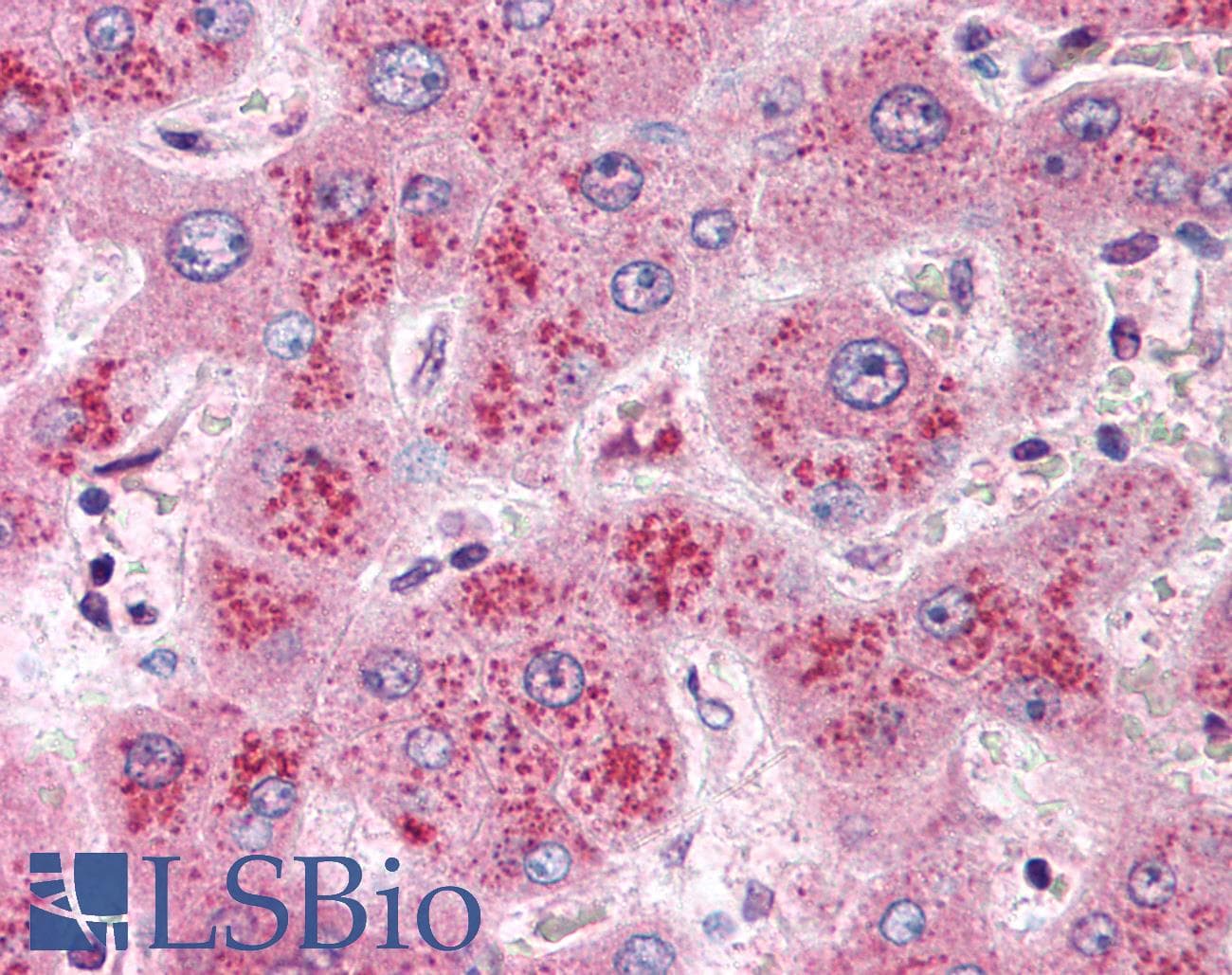 IHC-plus™ Polyclonal Rabbit anti-Human WNT11 Antibody (Internal, IHC)