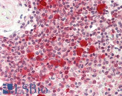 IHC-plus™ FKBP4 / FKBP52 Antibody (aa1-50)