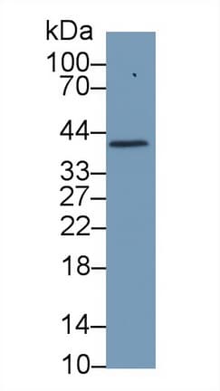 HP / Haptoglobin Antibody (aa123-307, Cy3)