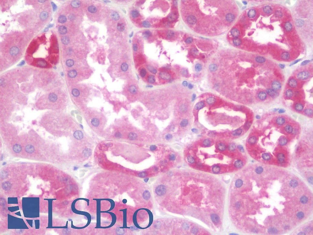 CBLN3 / Cerebellin 3 Antibody (aa131-180)