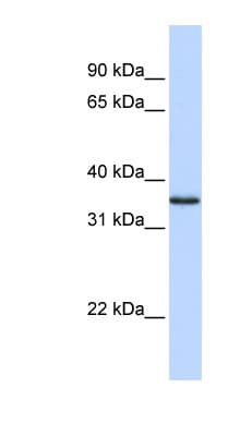 COPS5 / JAB1 Antibody (N-Terminus)