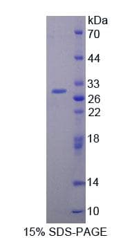 Rat PCM1 Protein (Recombinant His-T7)