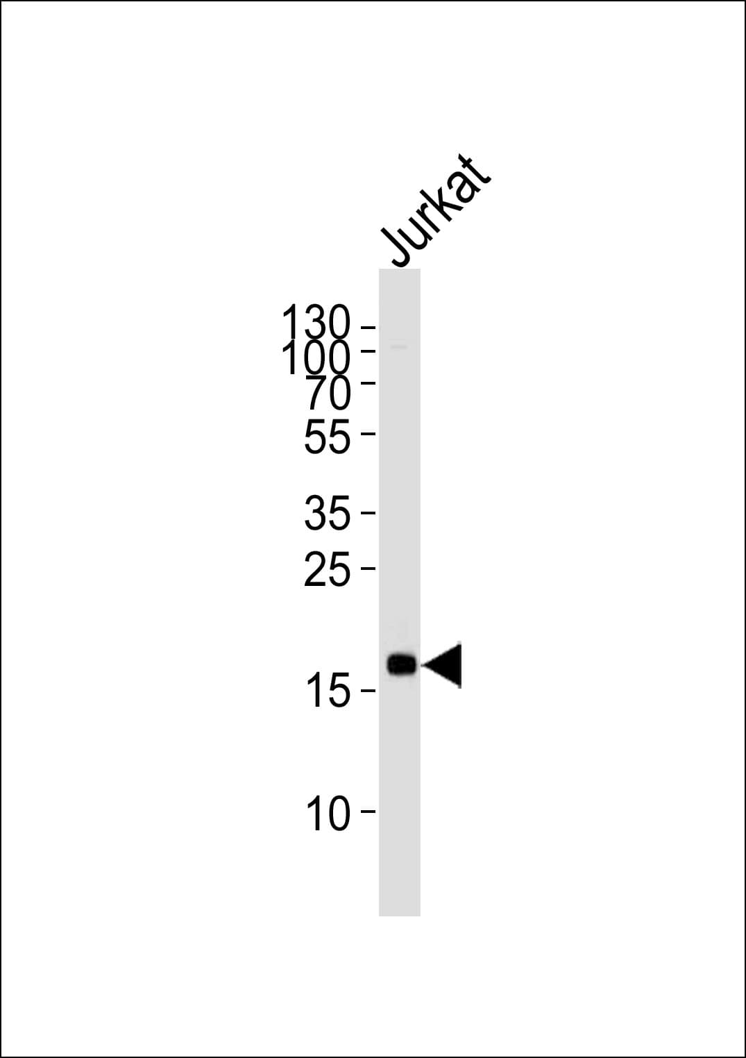 Monoclonal Mouse anti-Human MAFK Antibody (clone 1328CT786.105.125, WB)