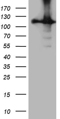 Monoclonal Mouse anti-Human HACE1 Antibody (clone OTI2C7, WB)