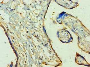 TP53I3 / PIG3 Antibody (aa163-332)
