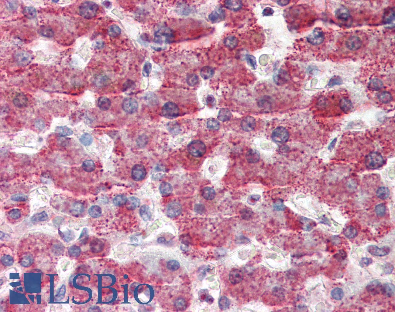 IHC-plus™ Polyclonal Goat anti-Human GOT2 Antibody (aa295-306, IHC, WB)
