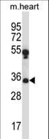 MARCH1 Antibody (aa163-191)