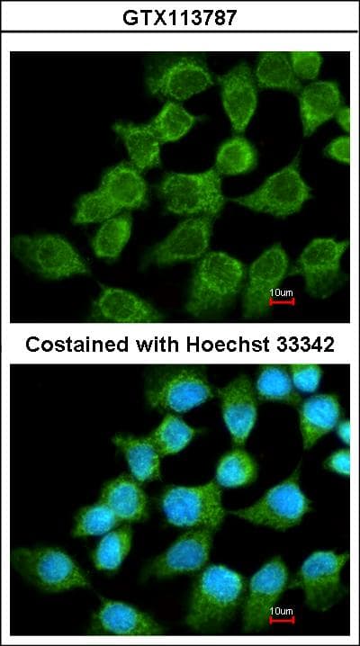 NDUFS1 Antibody (aa432-664)