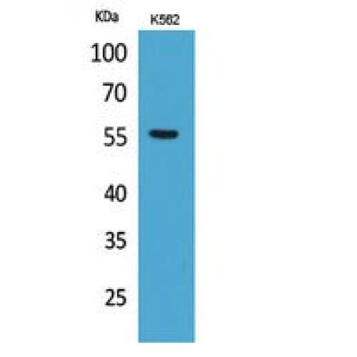 SLC2A5 / GLUT5 Antibody (21-70 aa, N-terminal)