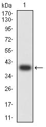 Monoclonal Mouse anti-Human GRIK5 / KA2 Antibody (clone 4G5H8, WB)