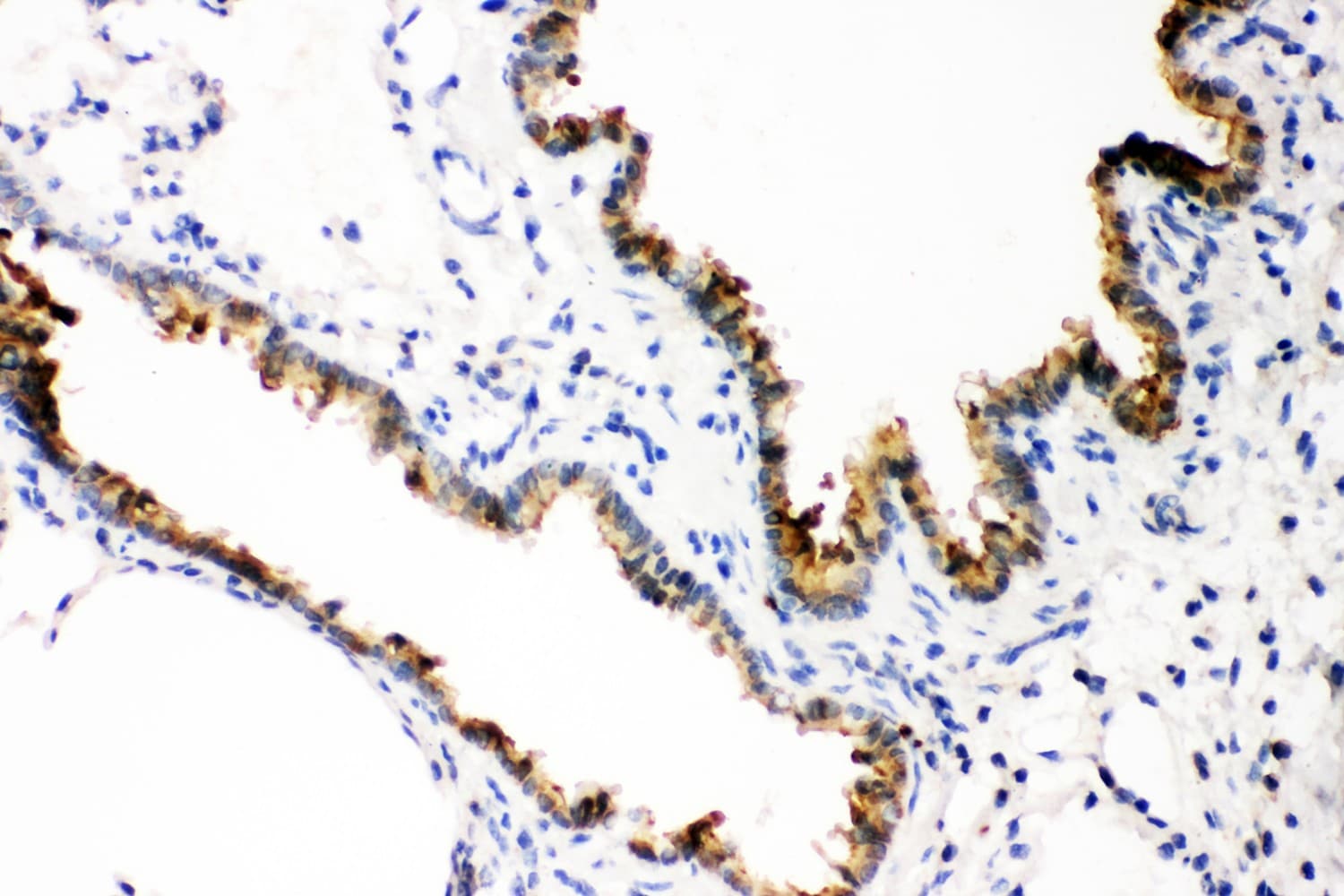 GSTP1 / GST Pi Antibody (aa2-210)