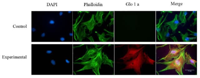 GLO1 / Glyoxalase I Antibody (clone Glo1a)