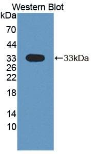 DSTYK / RIPK5 Antibody (aa650-904, Biotin)