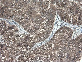 Monoclonal Mouse anti-Human PNPO Antibody (clone OTI1G9, IHC, WB)