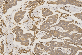 Polyclonal Rabbit anti-Human SFRP1 Antibody (IHC, WB)
