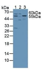 SPTLC1 / HSN1 Antibody (aa143-473, APC)