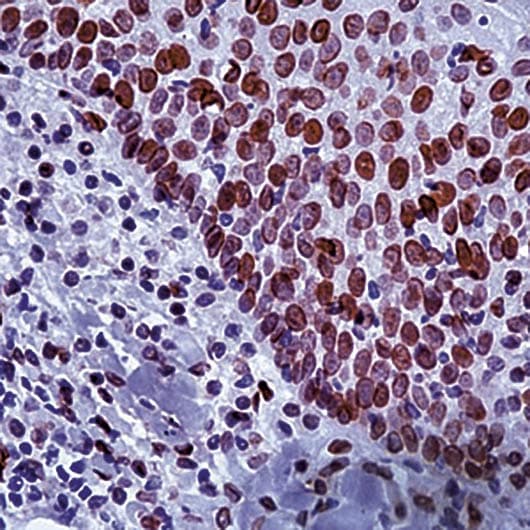E2F1 Antibody (clone KH95)