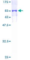 Human KRT6B / CK6B / Cytokeratin 6B Protein (Recombinant GST)