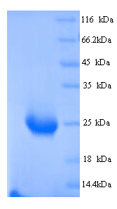 Human BTN2A1 Protein (Recombinant His)