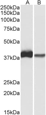 IHC-plus™ CAPG Antibody (aa205-217)