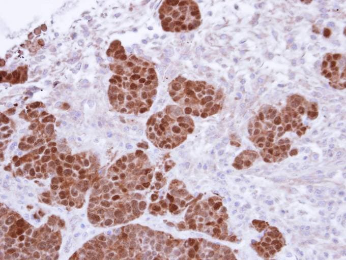 Polyclonal Rabbit anti-Human Calgizzarin / S100A11 Antibody (aa8-102, IHC, WB)