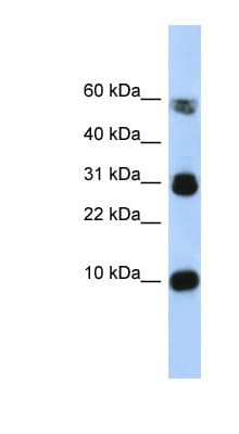 FABP4 / AP2 Antibody (aa71-120)