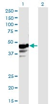 NAPRT Antibody (clone 4A9)