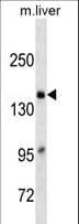 A2M / Alpha-2-Macroglobulin Antibody (aa1162-1192, clone 590CT15.5.5)