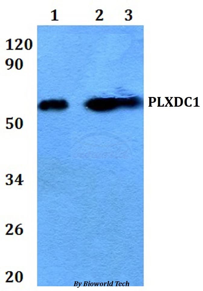 TEM7 Antibody