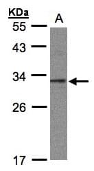 C20orf11 / TWA1 Antibody (aa1-208)