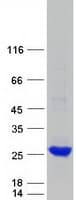Human FTHL17 Protein (Recombinant Myc-DDK (Flag))