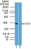 Polyclonal Rabbit anti-Human SOX1 Antibody (aa100-150, WB)