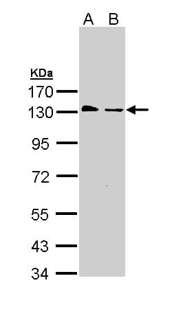 IHC-plus™ BUB1B / BubR1 Antibody