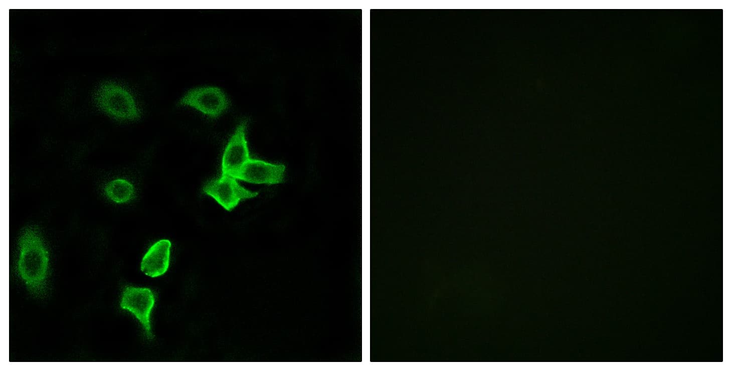 Polyclonal Rabbit anti-Human KANK2 Antibody (aa351-400, IHC, IF)