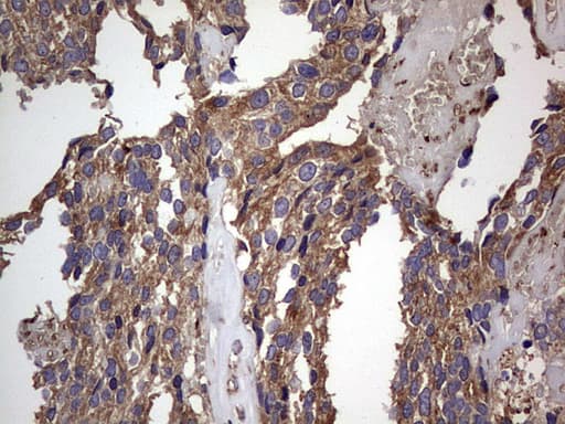 DOCK8 Antibody (aa832-1160, clone OTI4H10)