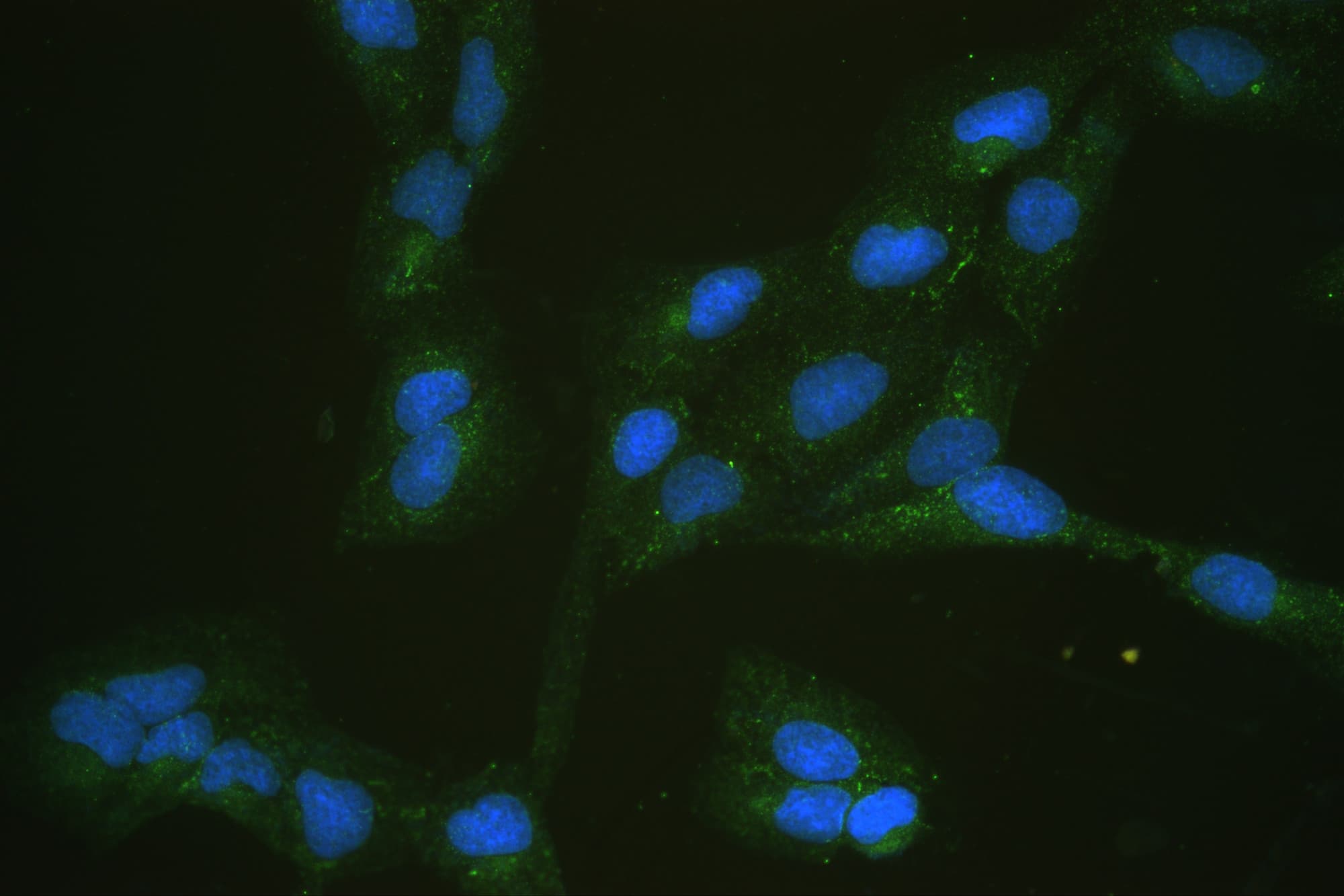 SLC2A5 / GLUT5 Antibody